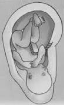 oreille3